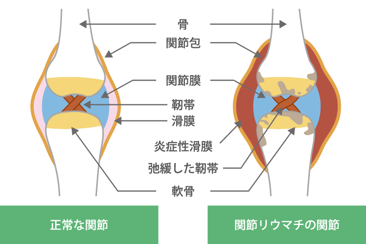 画像検査